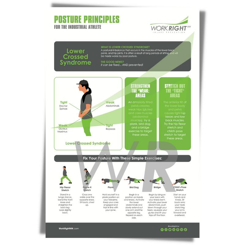 Posture Principles – Lower Crossed Syndrome